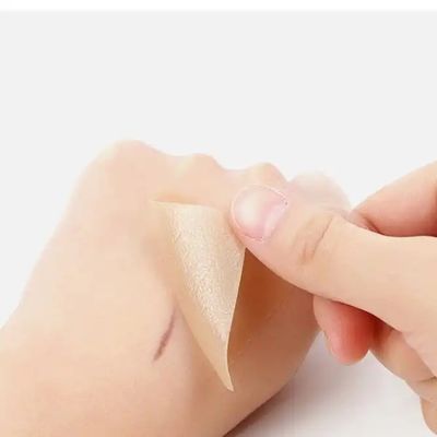 シリコン 傷痕 テープ ストライプ - 癒しのケロイド 帝王切開 腹部切開 - 手術 傷痕 治療